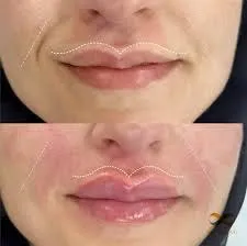 باقة تكساس وفيلر