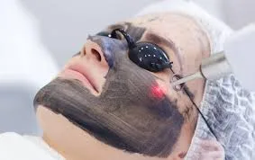 جلسة ليزر كربوني نجران دانة كلينك